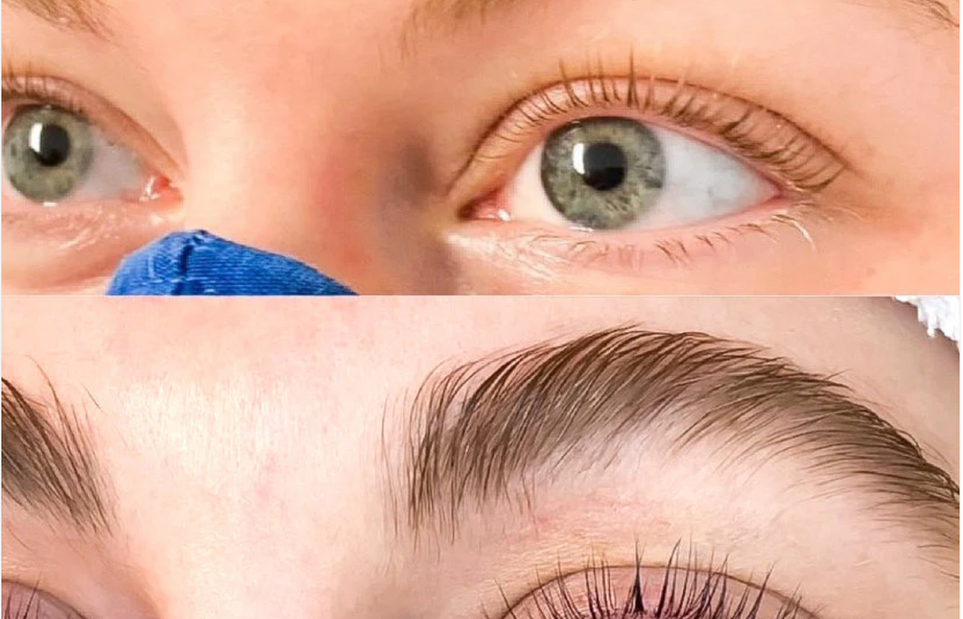 Why Are My Lashes Falling Out? Causes and Solutions
