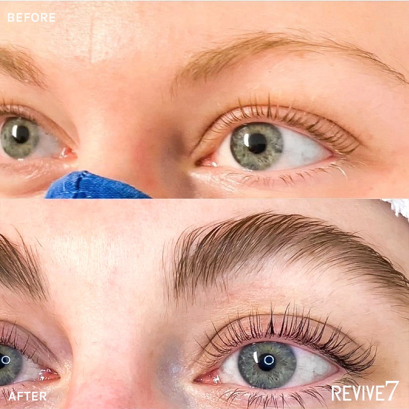 Lash Serum Before and After