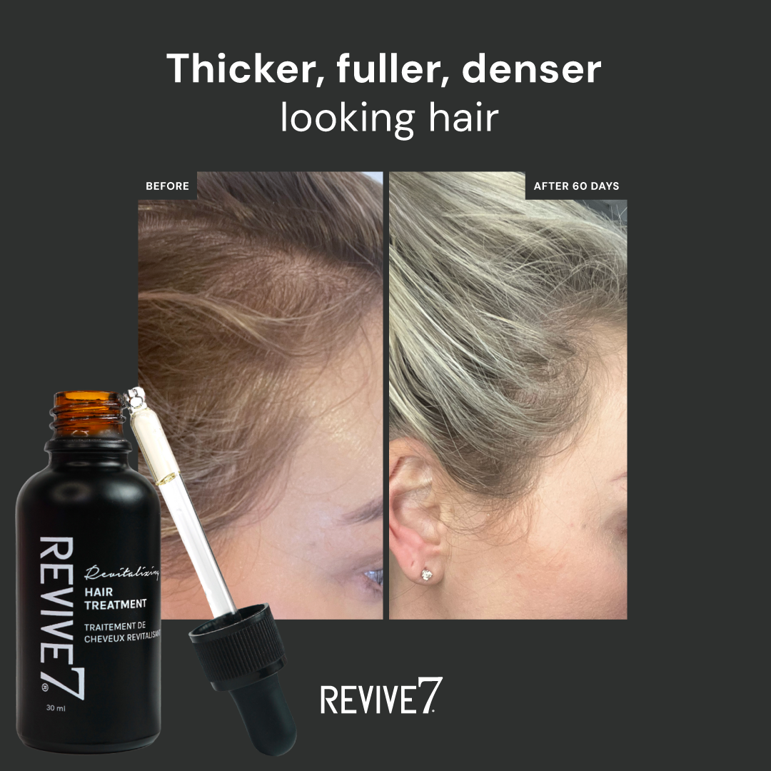 Hair Treatment in Canada