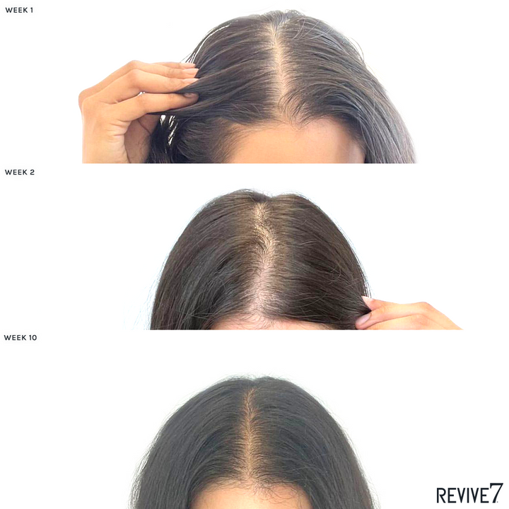 Before and After Hair Treatment with Revive7